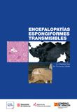 Encefalopatías espongiformes transmisibles